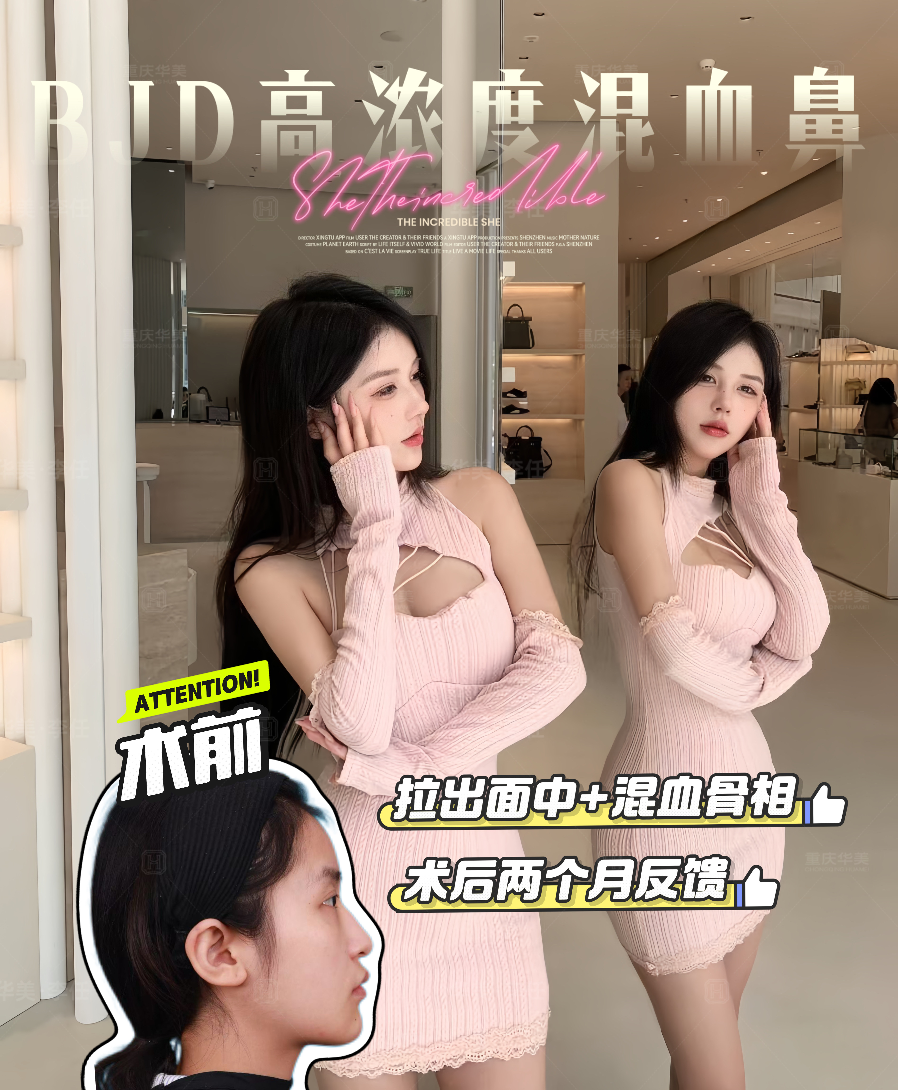 专业鼻整形怎么选?重庆华美整形靠谱之选 专业鼻整形怎么选?重庆华美整形靠谱之选