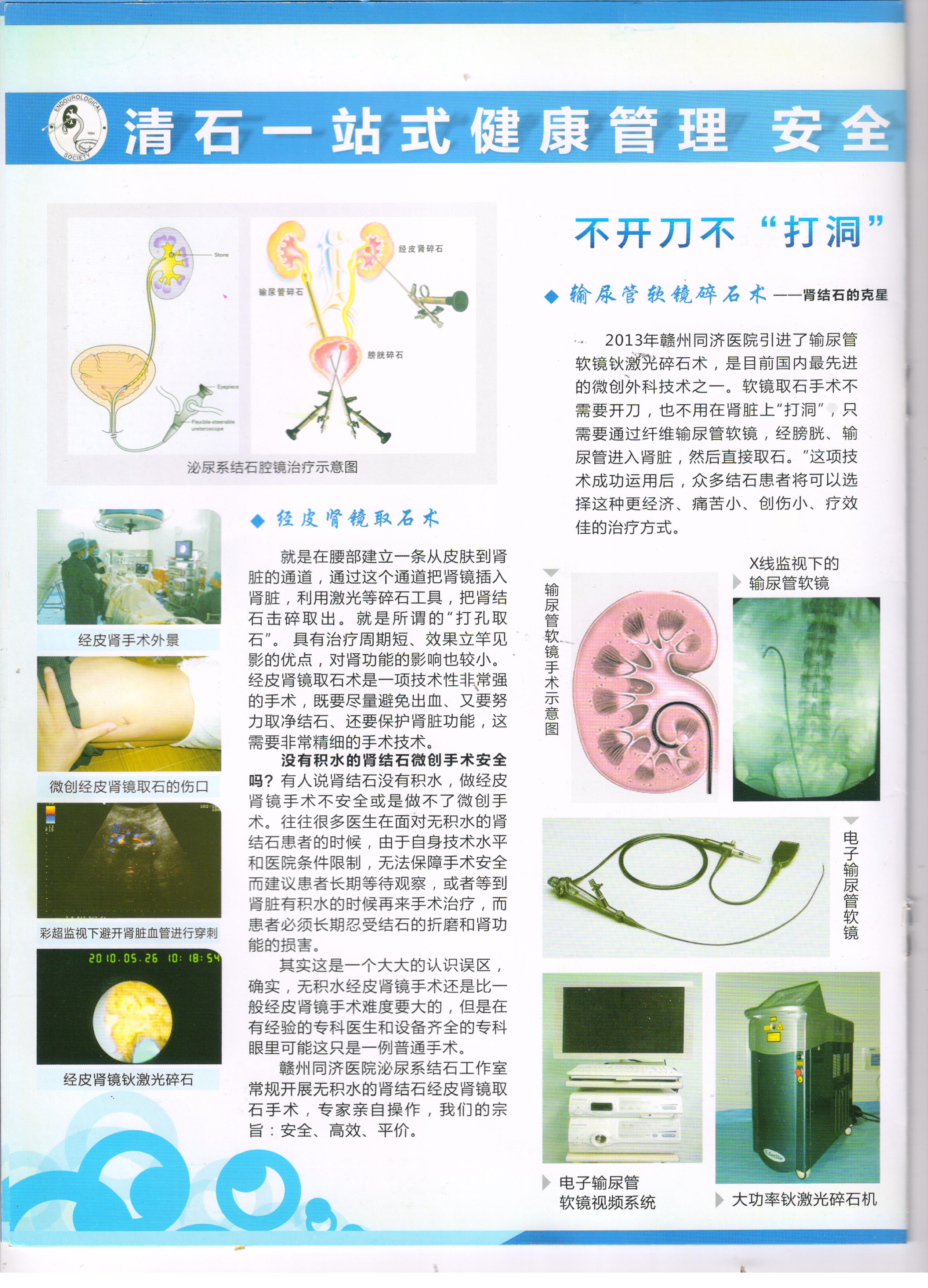梳理结石手术权威医院，靠谱的品牌有哪些