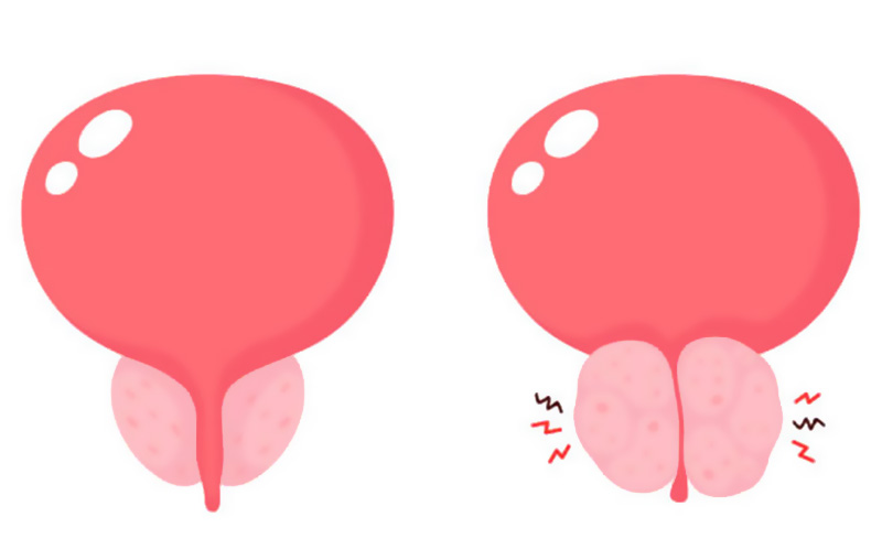 天津治疗前列腺炎男科医院怎么选，不再迷茫