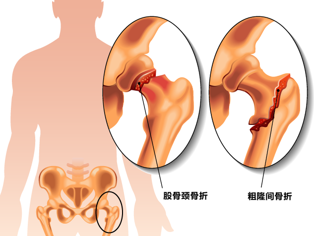 和你一起品味骨科医院的优质服务体验