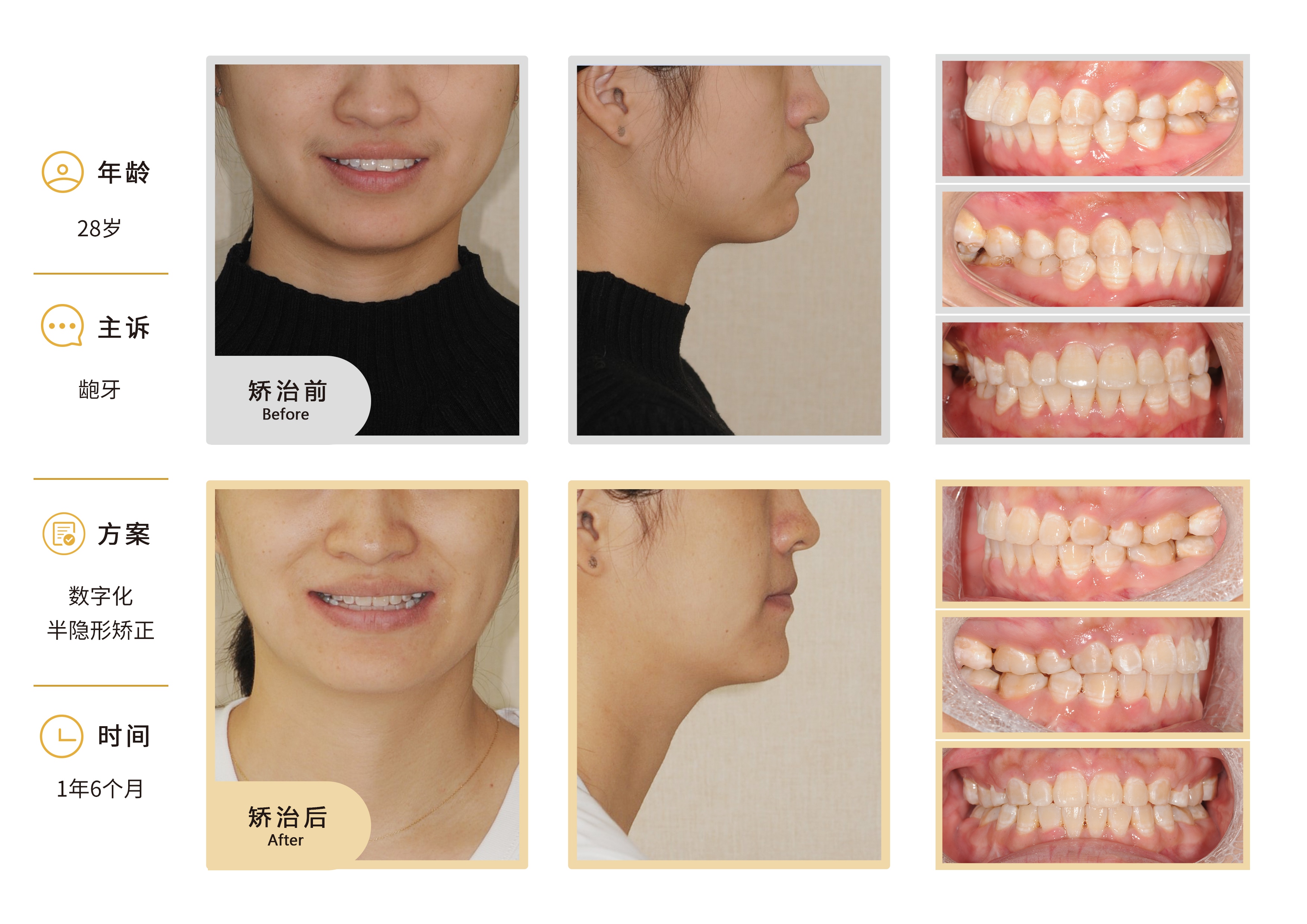 2026年廊坊牙齿正畸公司费用大揭秘，济民口腔性价比超赞