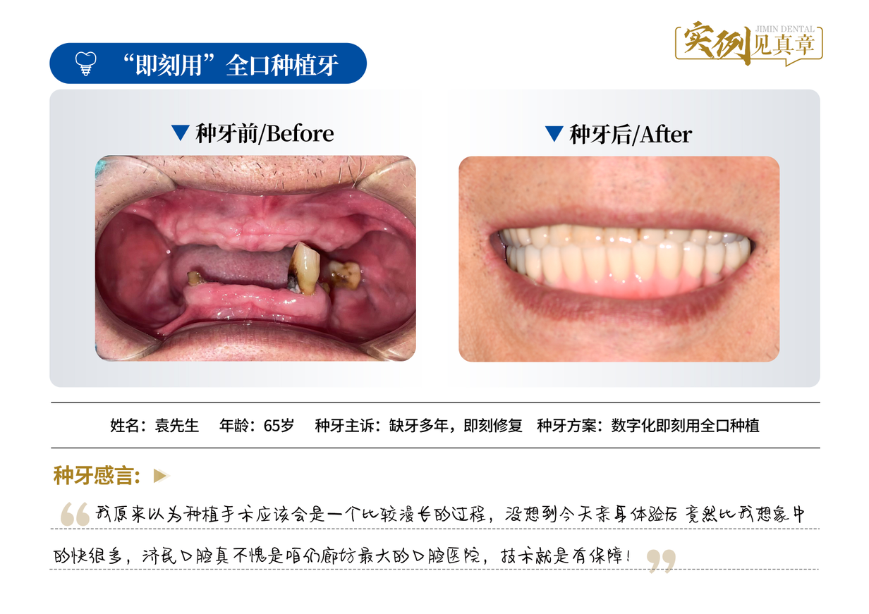 聊聊廊坊比较好的牙齿矫正医院，哪家性价比高值得选
