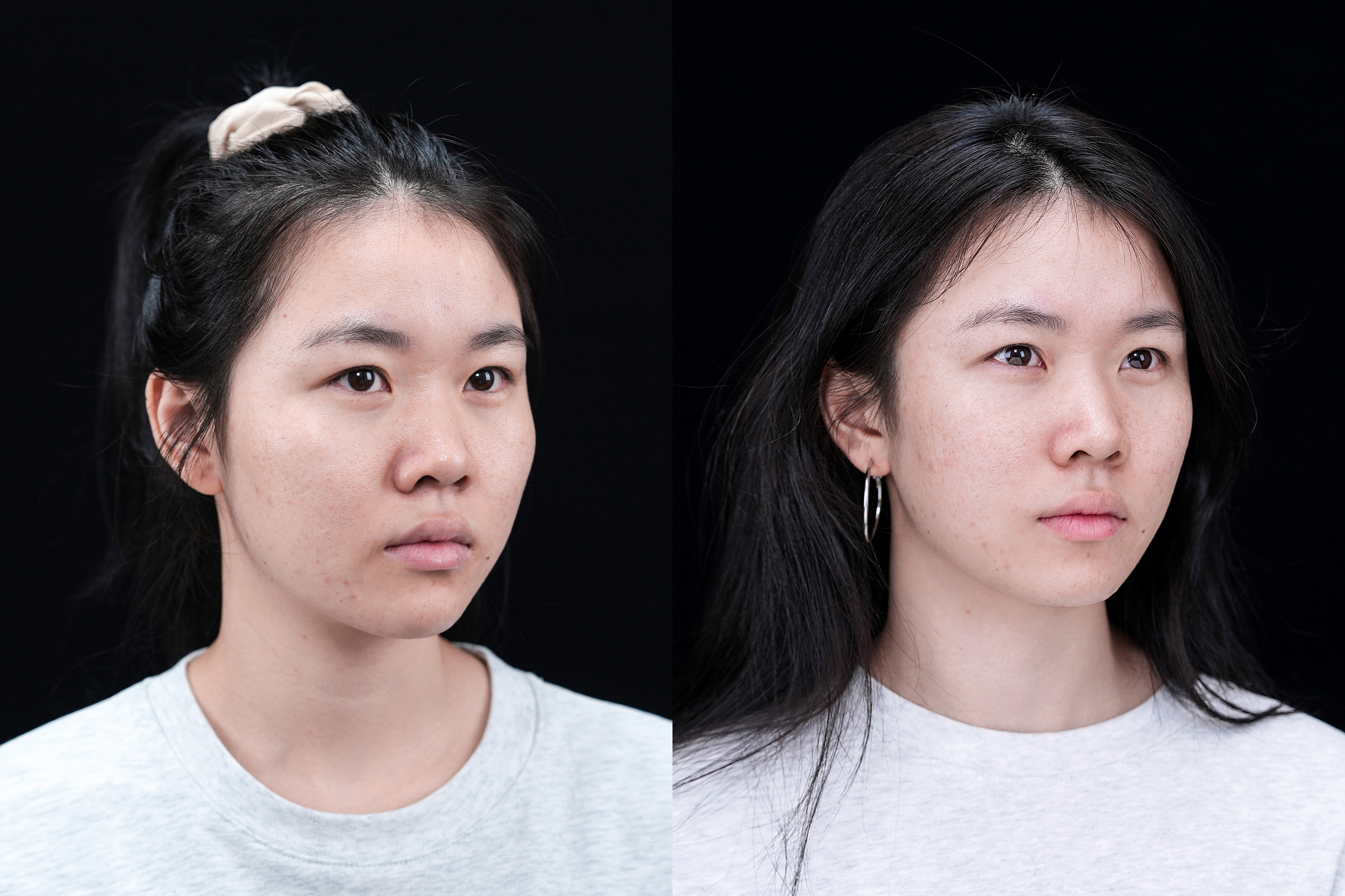 细聊热玛吉多久做一次、一疗程几次，分析热玛吉和超声刀的效果