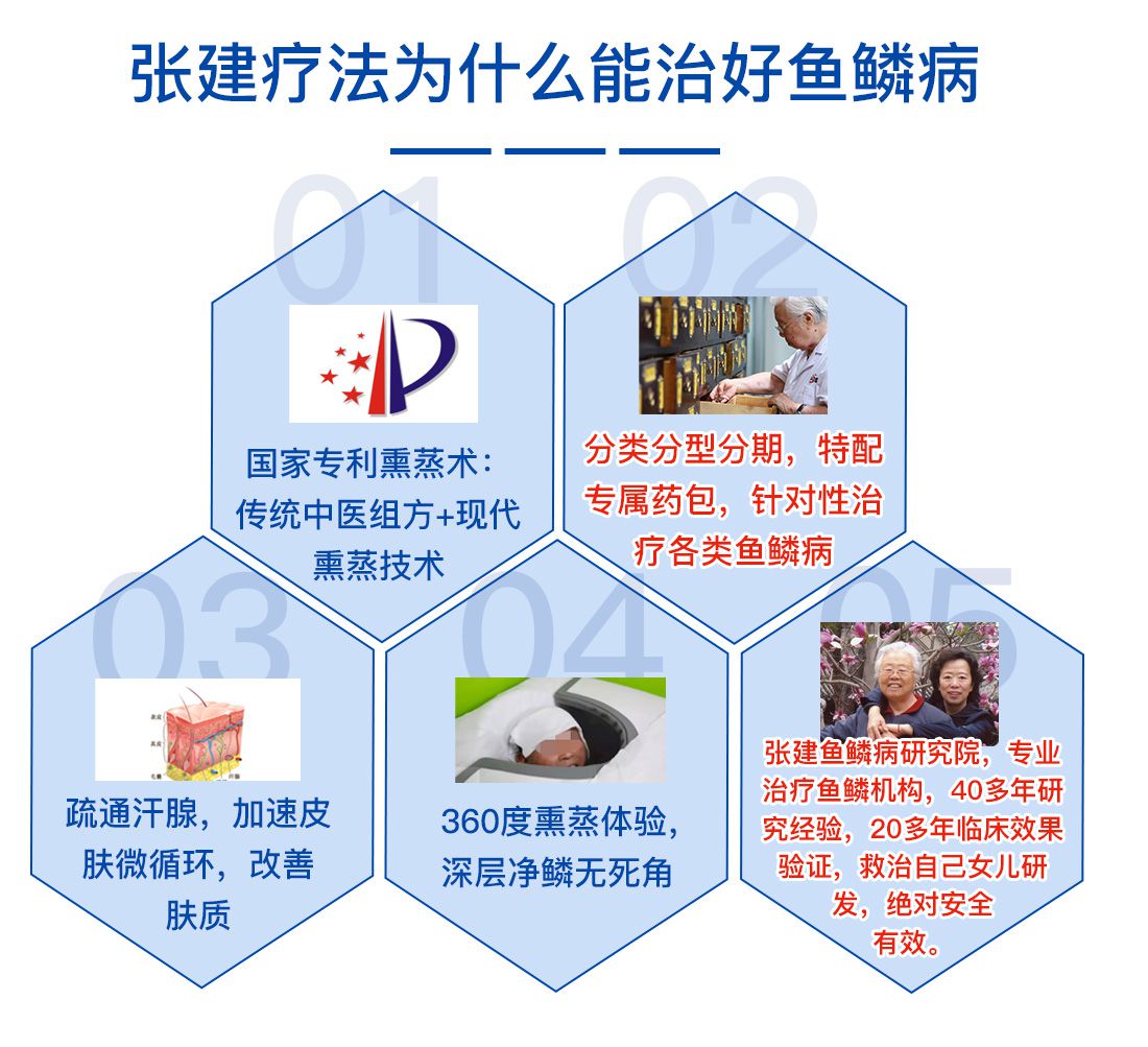 深聊蛇皮肤病治疗哪里靠谱 哪家性价比高有推荐 深聊蛇皮肤病治疗哪里靠谱 哪家性价比高有推荐