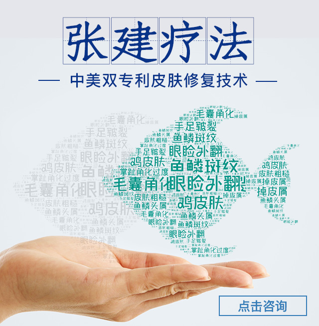 在北京，蛇皮病治疗该怎么选择，北京张建鱼鳞病研究院是不错之选