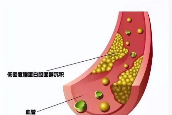 山楂精降脂滴丸，推荐哪家?解密其优势