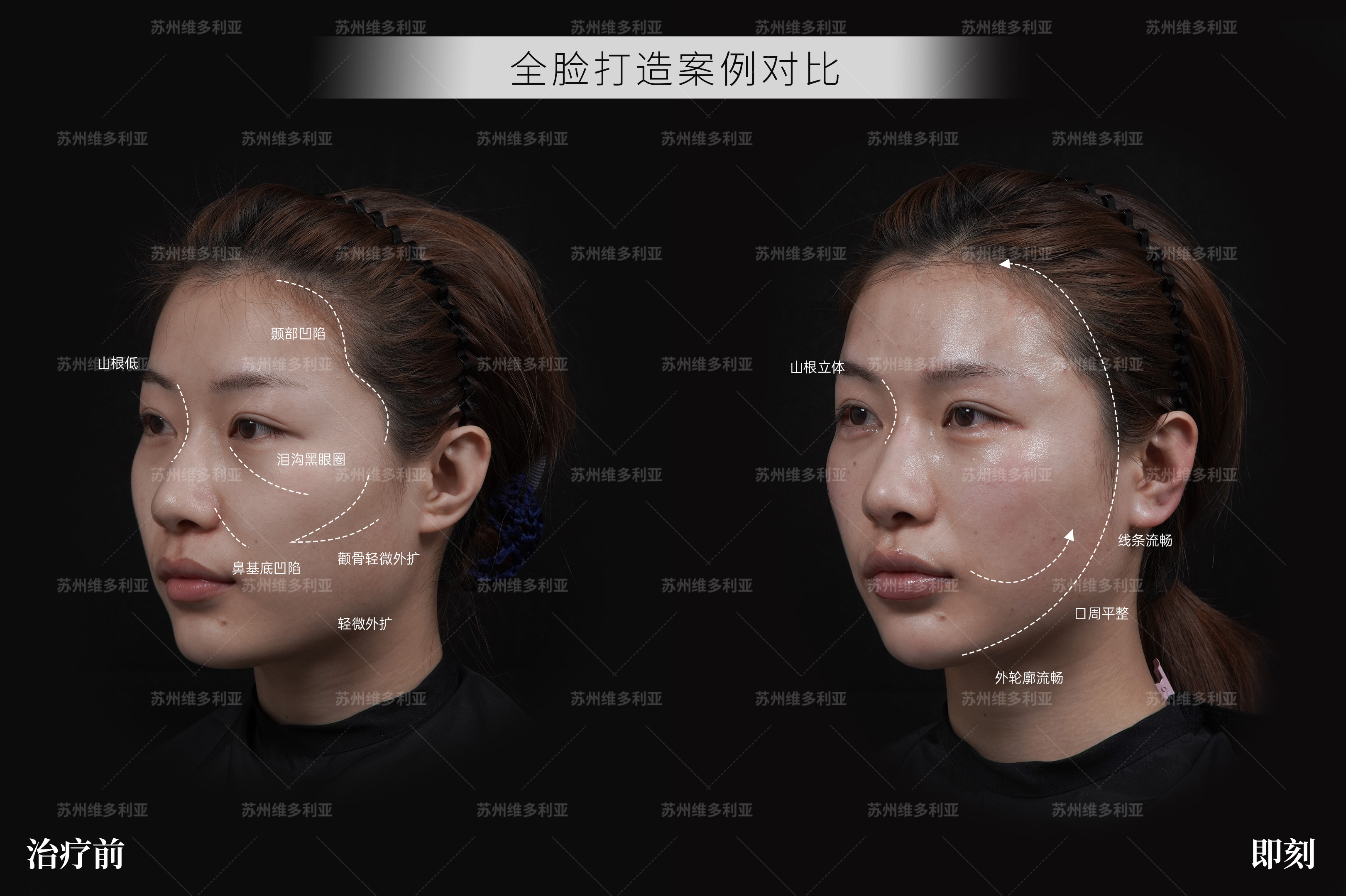 聊聊想解决化妆脱妆、改善皮肤亚健康的水光，推荐哪家性价比高