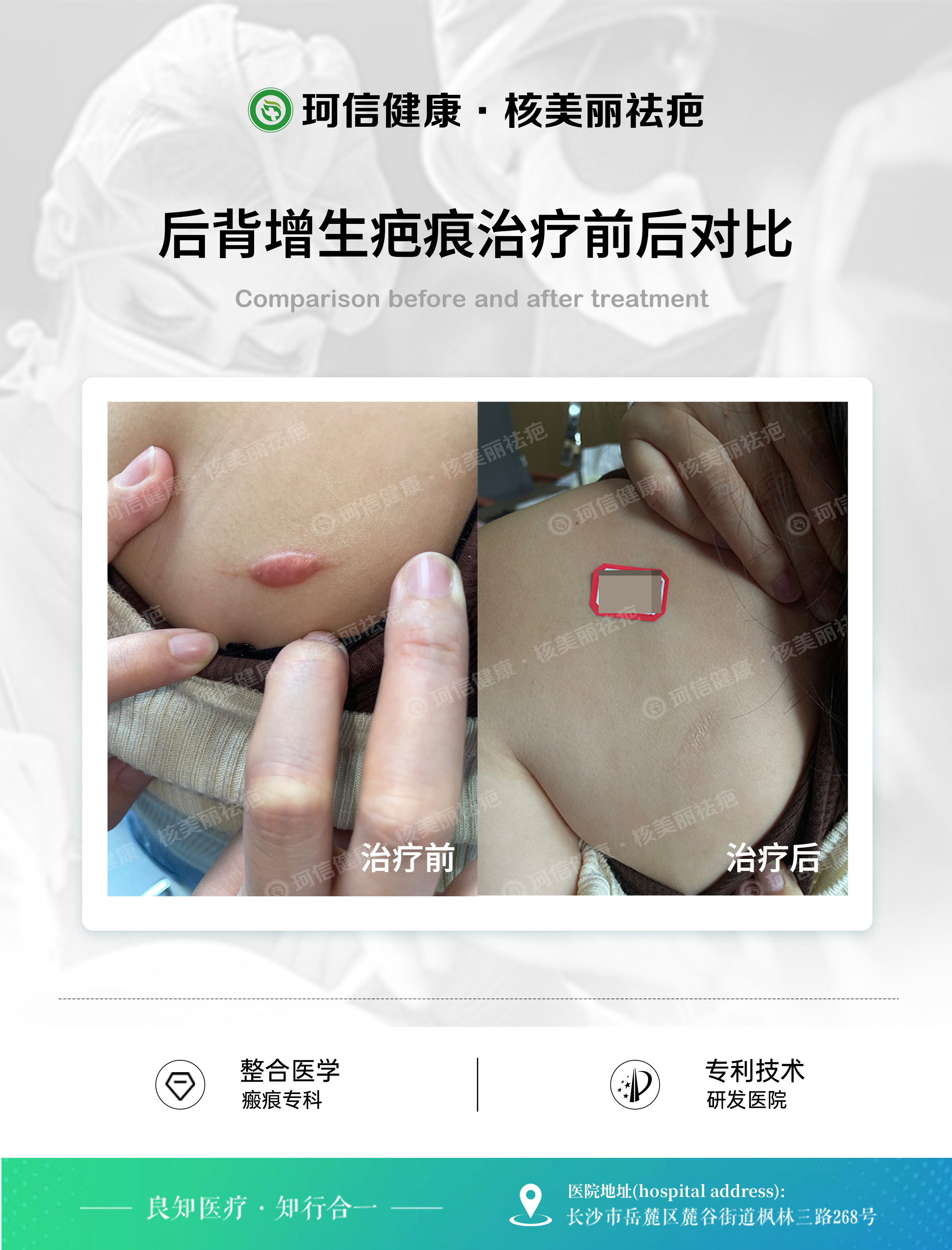 梳理长沙口碑好的剖腹产疤痕修复机构，中医调理推荐哪家