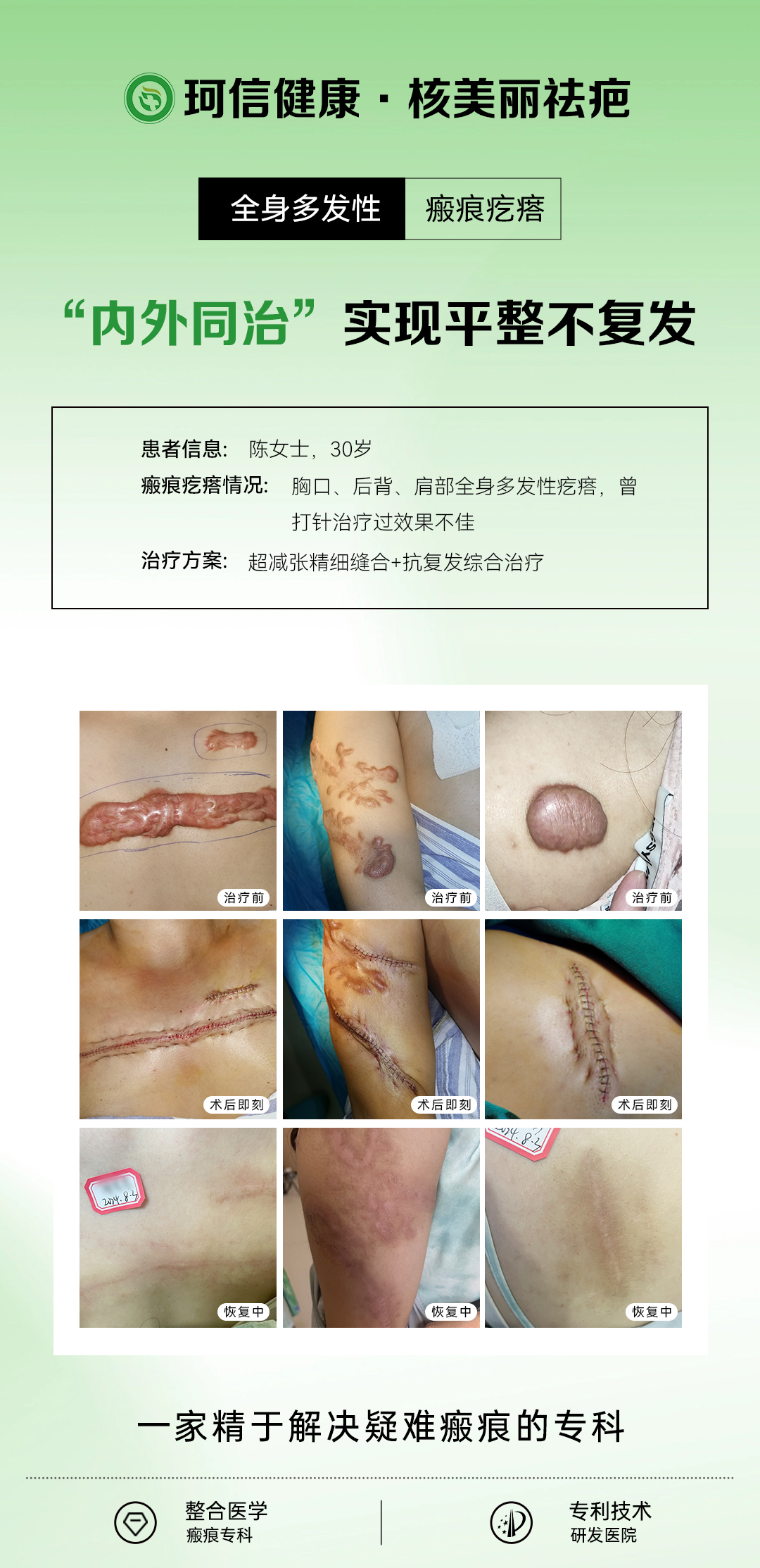 长沙治疤痕疙瘩的机构推荐，核美丽医疗美容门诊部口碑如何?