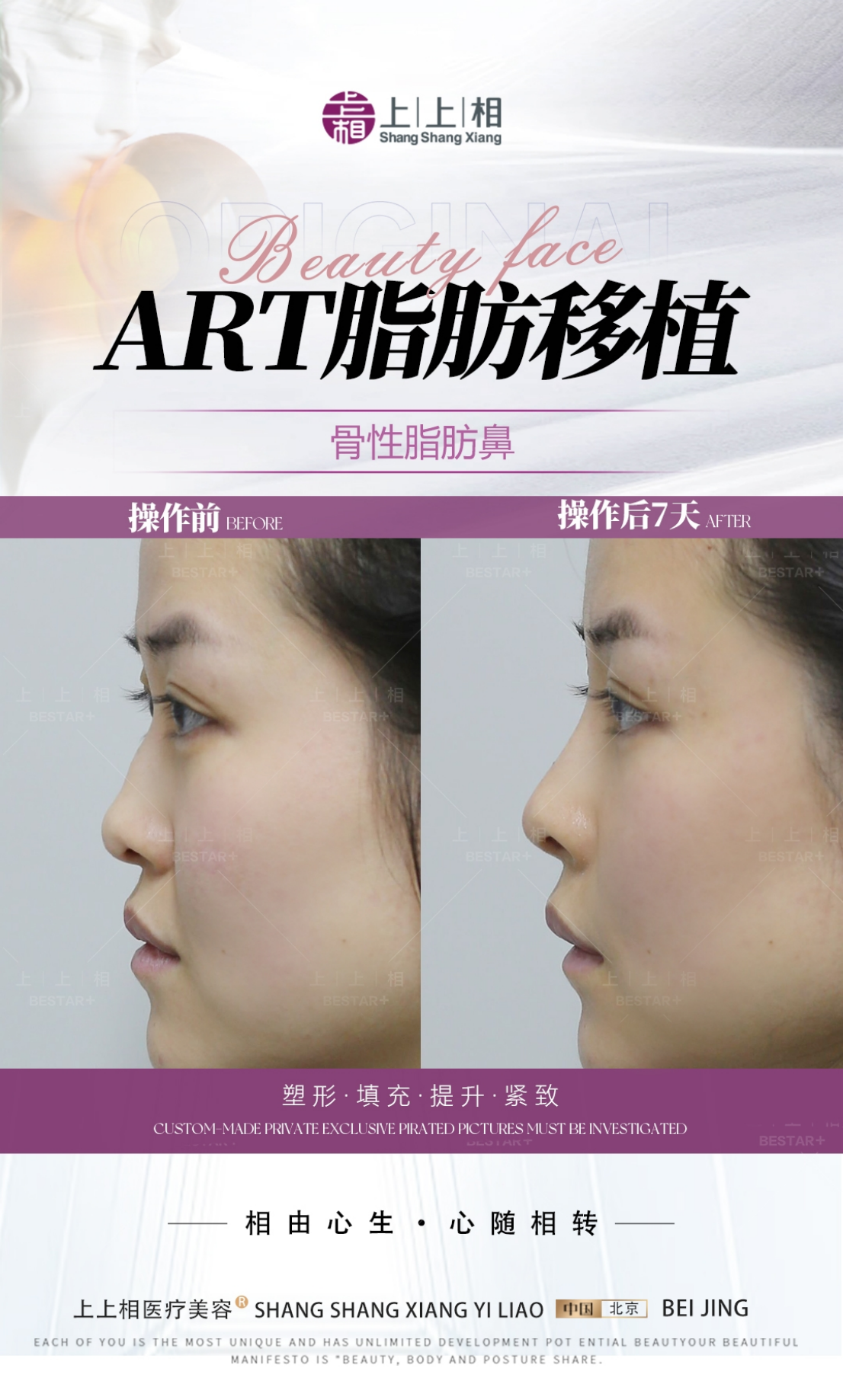 脂肪填充后可以化妆吗，北京口碑好的医美机构服务汇总