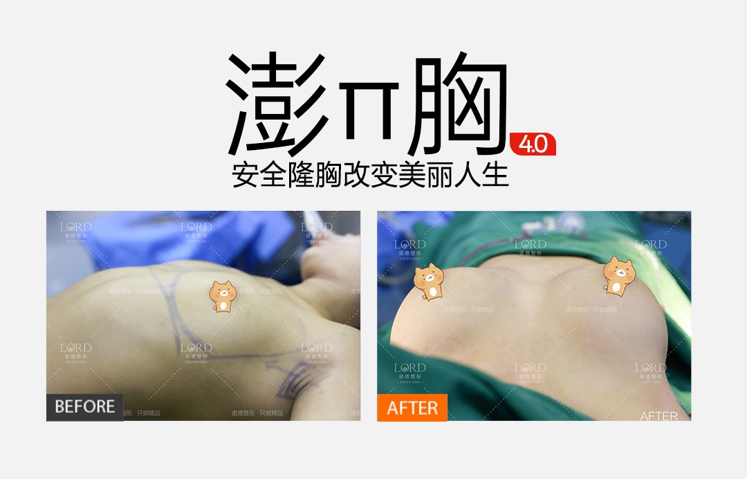 2026年济南口碑不错的隆鼻机构推荐：诺德美容医院，创新技术备受推崇
