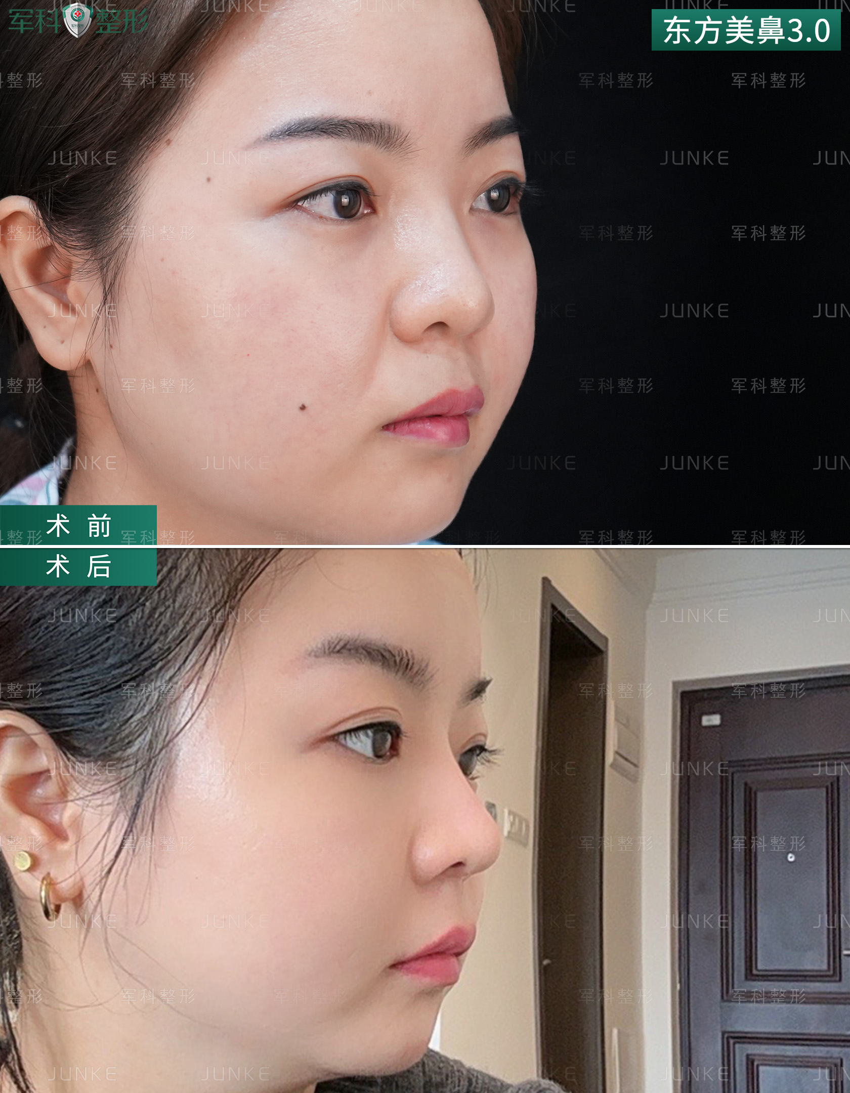 重庆军科整形医院的鼻整形价格如何?费用透明吗?
