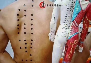 2026年北京正规的针灸培训推荐哪家好客户口碑力荐