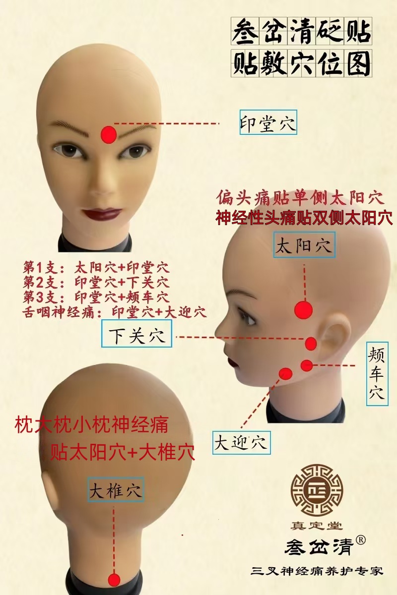 三叉神经痛治疗周期多久？真定堂告诉你