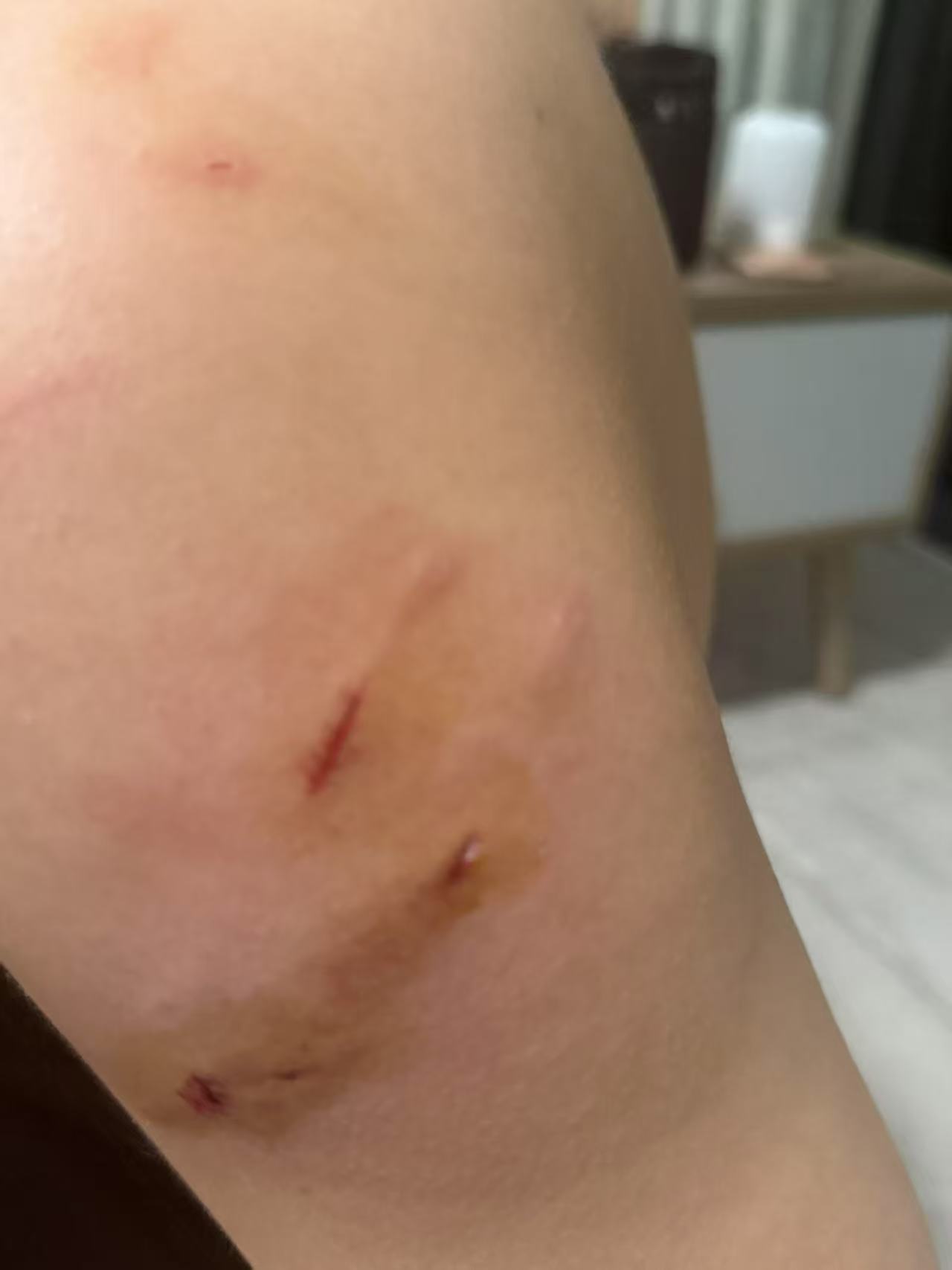 ��ɳ��´��ҹ���Ȯ��������ҽ�Ƶ�λ����