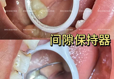 2026年正规的儿童口腔医院公益筛查活动实力与用户口碑