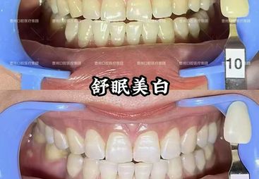 2026年靠谱的牙齿美白修复口腔医院，做口腔美学修复用户力荐
