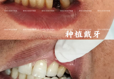 2026年靠谱的商丘周边种牙口腔机构综合实力推荐