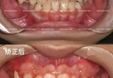 菏泽东明县能做隐形牙齿矫正的口腔医院客户口碑力荐