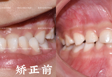 资质齐全的牙齿矫正机构挑选指南，曹州口腔医院行业观察