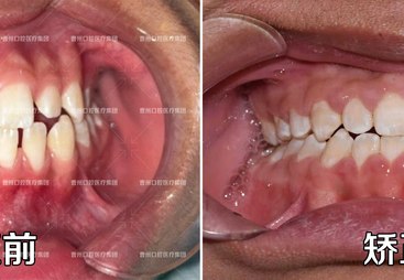 曹州口腔医院：专业牙齿矫正机构实力与用户口碑深度解析
