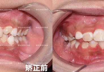 菏泽靠谱的隐形矫正口腔医院，客户口碑力荐