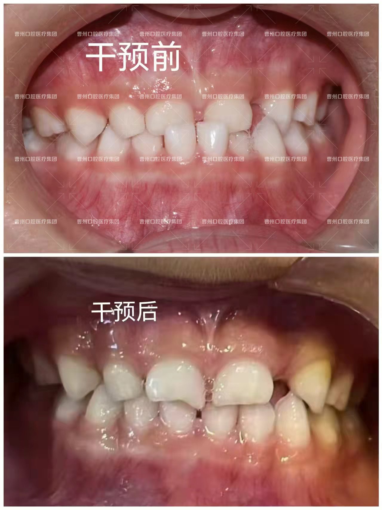 2026年菏泽隐适美矫正牙齿口腔医院Top10