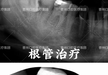 2026年靠谱的牙周治疗口腔医院：曹州口腔医院专业实力与用户口碑深度解析