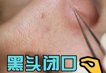 漳州皮肤管理服务商推荐，专业同城皮肤管理门店新颜美肌中心