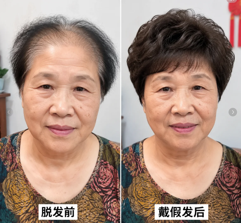 男士假发生产厂家哪家专业？2026年靠谱商家测评