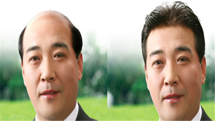 男士假发生产厂家哪家专业？2026年靠谱商家测评