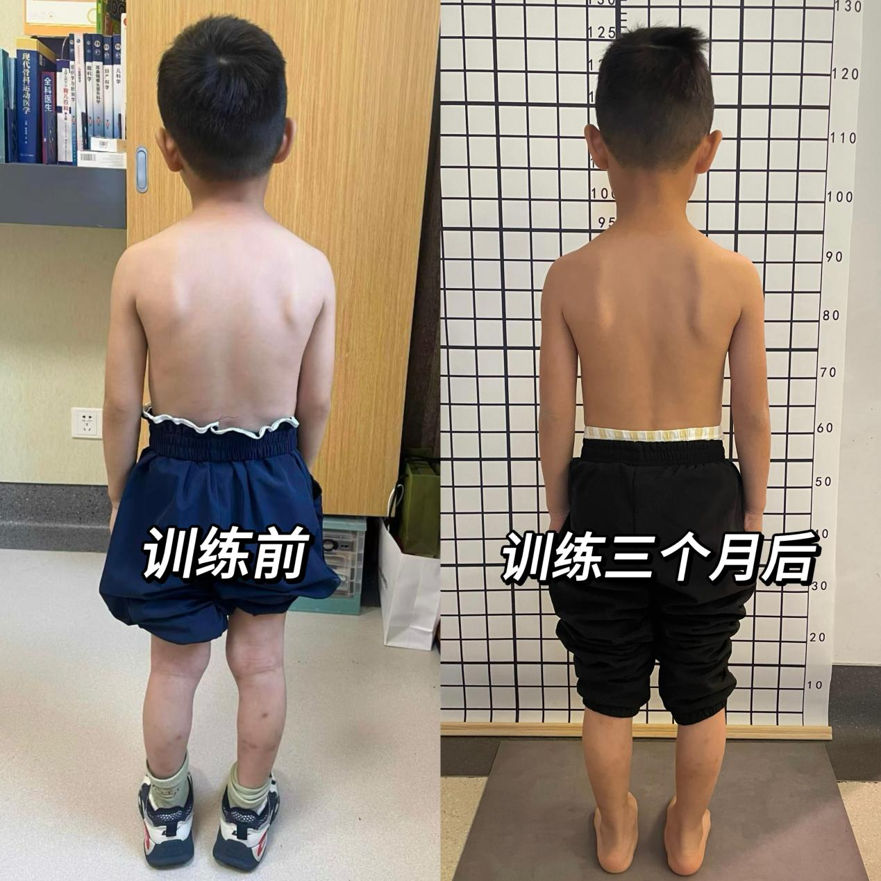 2026脊柱侧弯矫正机构客户口碑力荐，高认可度专业机构盘点，零套路体验