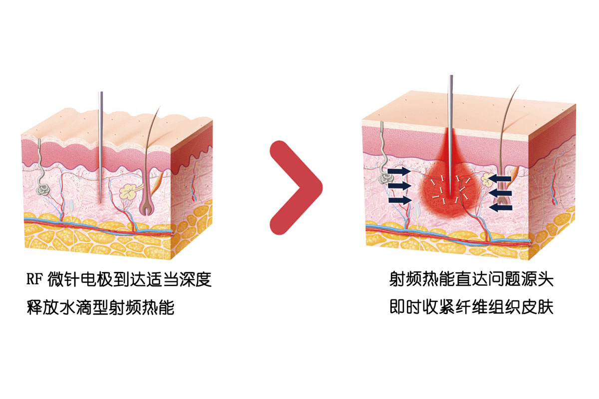ͼ2